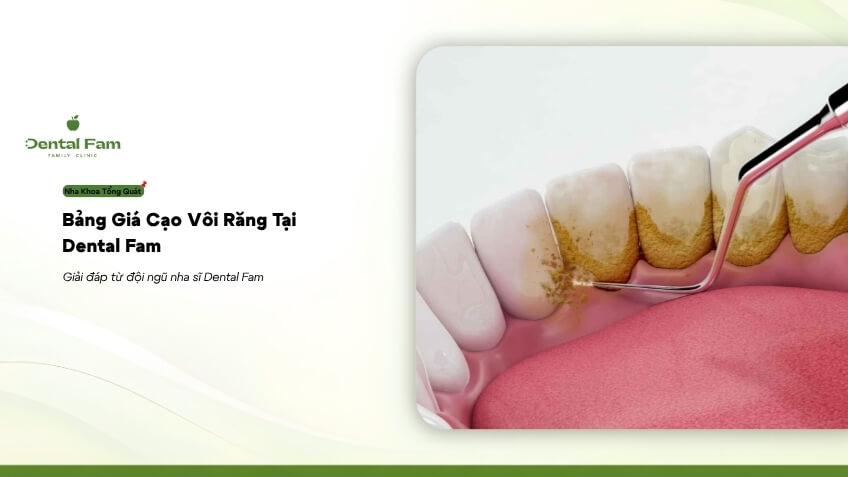 Прайс-лист на удаление зубного камня в клинике Dental Fam