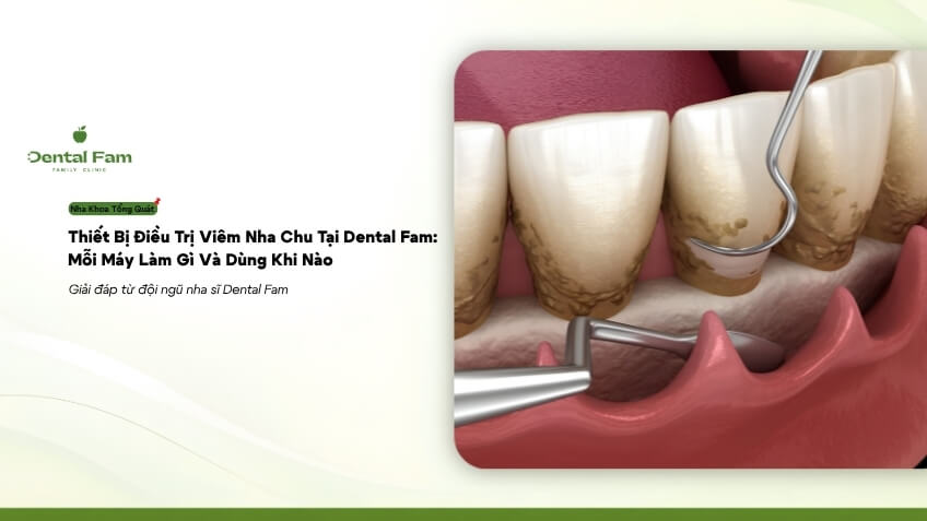 Аппараты для лечения пародонтита Dental Fam: для чего нужен каждый аппарат и когда их использовать.